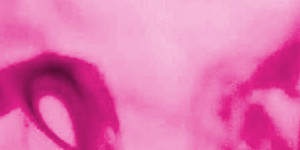 UpRight:  | TEMPLATED